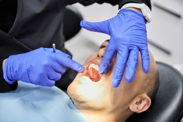 Best Emergency Dental Extractions in Cedar Rapids, IA